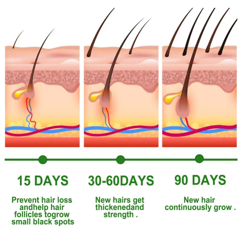 The Root Ritual Spray — Rosemary Hair Growth Oil