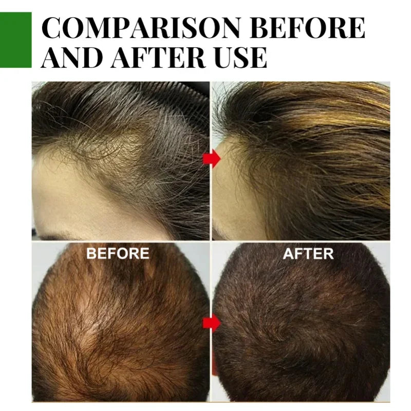The Root Ritual Spray — Rosemary Hair Growth Oil